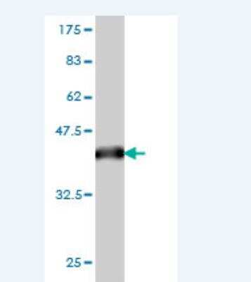 Western Blot: ERF Antibody (1E5) [H00002077-M01]