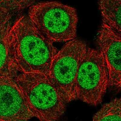 Immunocytochemistry/ Immunofluorescence: ERF Antibody [NBP2-49538]