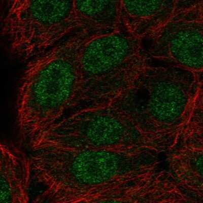 Immunocytochemistry/ Immunofluorescence: ERF Antibody [NBP2-56079]