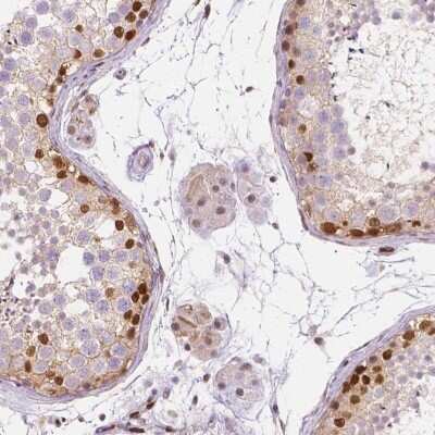 Immunohistochemistry-Paraffin: ERF Antibody [NBP2-49538]