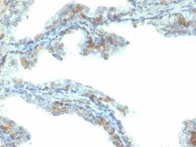 Immunohistochemistry-Paraffin: ERG Antibody (ERG/2107) [NBP3-07172]