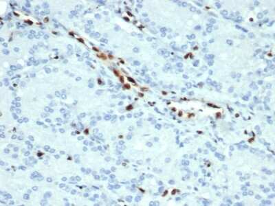 Immunohistochemistry-Paraffin: ERG Antibody (ERG/22R) - Azide and BSA Free [NBP3-08916]