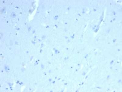 Immunohistochemistry-Paraffin: ERG Antibody (ERG/22R) - Azide and BSA Free [NBP3-08916]