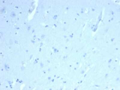 Immunohistochemistry-Paraffin: ERG Antibody (ERG/22R) [NBP3-07173]