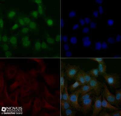 Immunocytochemistry/ Immunofluorescence: ERG Antibody - BSA Free [NBP2-60655]