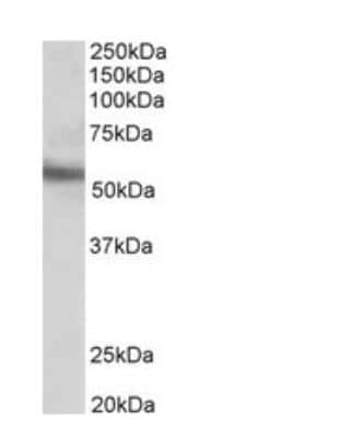 Western Blot: ERG Antibody [NB100-2472]