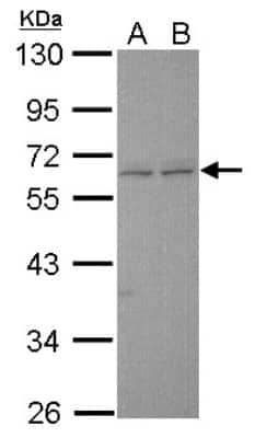 Western Blot: ERG Antibody [NBP1-31370]