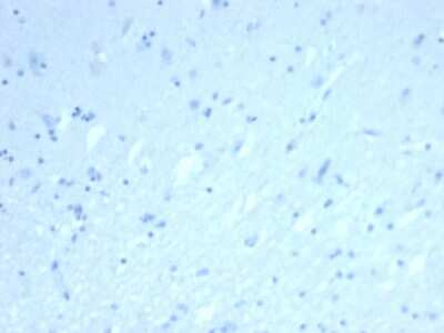 Immunohistochemistry-Paraffin: ERG Antibody (rERG/6843) [NBP3-13875]