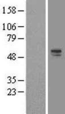 Western Blot: ERG Overexpression Lysate [NBL1-10327]