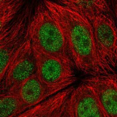 Immunocytochemistry/ Immunofluorescence: ERG28 Antibody [NBP2-57599]