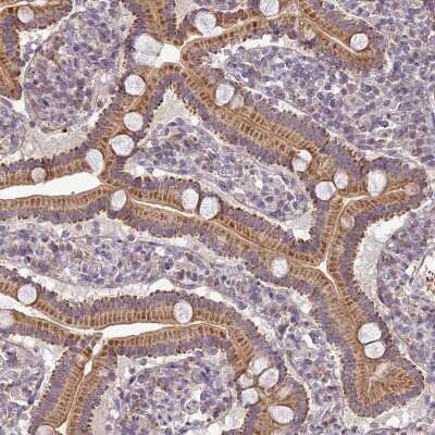 Immunohistochemistry-Paraffin: ERG28 Antibody [NBP1-87944]