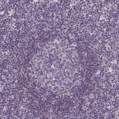 Immunohistochemistry-Paraffin: ERG28 Antibody [NBP1-87944]