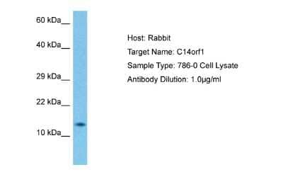 Western Blot: ERG28 Antibody [NBP2-84865]