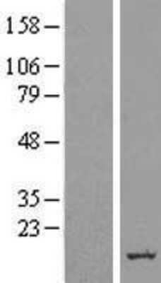 Western Blot: ERG28 Overexpression Lysate [NBL1-08166]