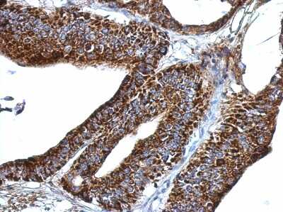 Immunohistochemistry-Paraffin: ERGI3 Antibody [NBP2-16367]