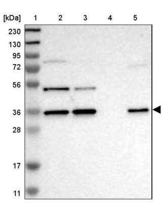 Western Blot: ERGI3 Antibody [NBP1-89881]