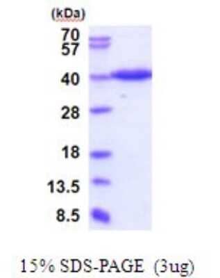 SDS-PAGE: Recombinant Human ERGI3 His Protein [NBP2-51937]