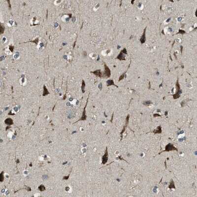 Immunohistochemistry-Paraffin: ERGIC1 Antibody [NBP1-83963]