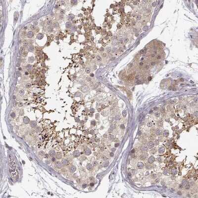 Immunohistochemistry-Paraffin: ERGIC2 Antibody [NBP2-56121]
