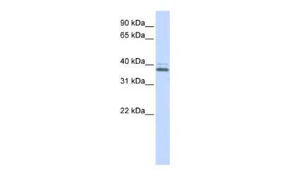 Western Blot: ERGIC2 Antibody [NBP2-83020]