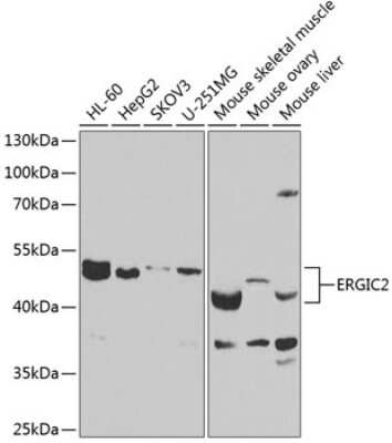 Western Blot: ERGIC2 AntibodyBSA Free [NBP3-05108]