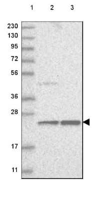 Western Blot: ERI3 Antibody [NBP2-48591]