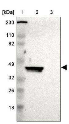 Western Blot: ERICH1 Antibody [NBP1-90952]