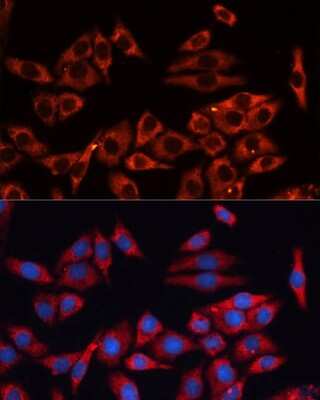 Immunocytochemistry/ Immunofluorescence: ERK1/2 Antibody - Azide and BSA Free [NBP3-05645]