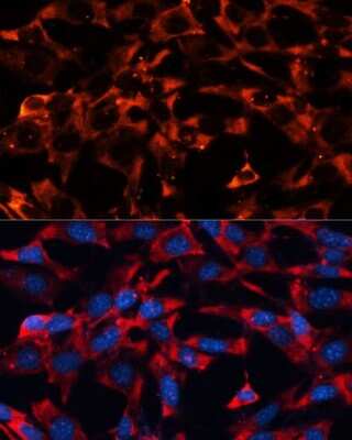 Immunocytochemistry/ Immunofluorescence: ERK1/2 Antibody - Azide and BSA Free [NBP3-05645]