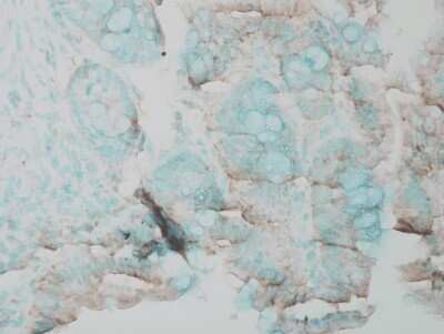 Immunohistochemistry: ERK1/2 Antibody [NB110-96887]