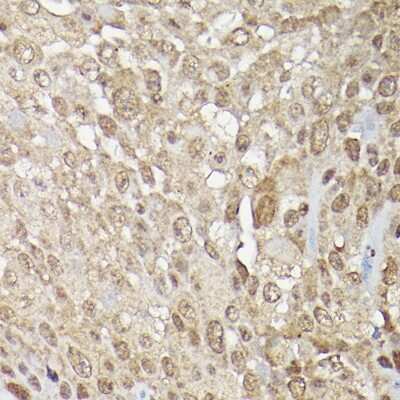 Immunohistochemistry-Paraffin: ERK1/2 Antibody - Azide and BSA Free [NBP3-05652]