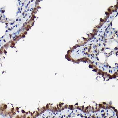 Immunohistochemistry-Paraffin: ERK1/2 Antibody - Azide and BSA Free [NBP3-05652]