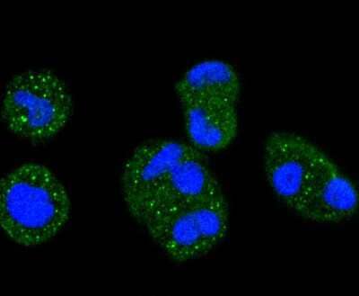 Immunocytochemistry/ Immunofluorescence: ERK1/2 Antibody (SP05-09) [NBP2-67373]