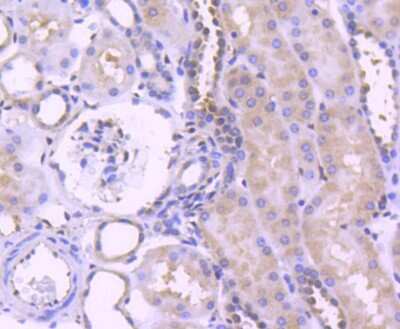 Immunohistochemistry-Paraffin: ERK1/2 Antibody (SP05-09) [NBP2-67373]