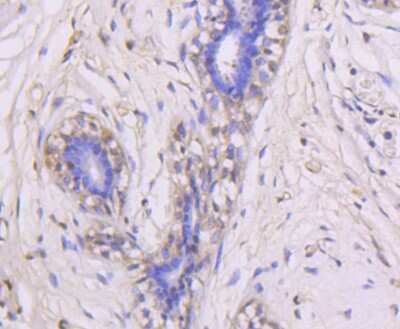 Immunohistochemistry-Paraffin: ERK1/2 Antibody (SP05-09) [NBP2-67378]