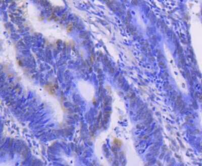 Immunohistochemistry-Paraffin: ERK1/2 Antibody (SP05-09) [NBP2-67378]
