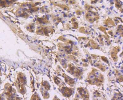 Immunohistochemistry-Paraffin: ERK1/2 Antibody (SP05-09) [NBP2-67378]