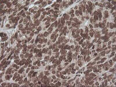 Immunohistochemistry: ERK1 Antibody (OTI4D7) - Azide and BSA Free [NBP2-71239]