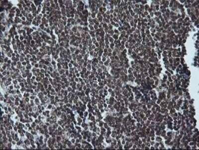 Immunohistochemistry: ERK1 Antibody (OTI4D7) - Azide and BSA Free [NBP2-71239]