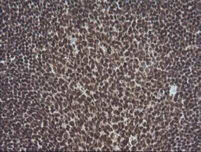 Immunohistochemistry: ERK1 Antibody (OTI4D7) - Azide and BSA Free [NBP2-71239]