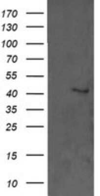 Western Blot: ERK1 Antibody (OTI4D7)Azide and BSA Free [NBP2-71239]