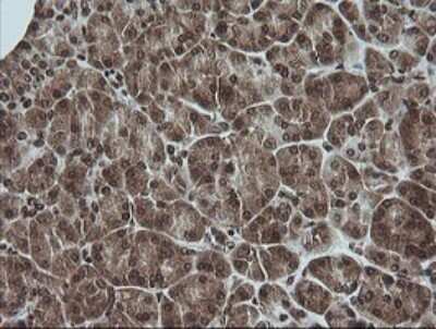 Immunohistochemistry: ERK1 Antibody (OTI4D7) [NBP2-45814]