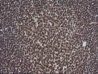 Immunohistochemistry: ERK1 Antibody (OTI4D7) [NBP2-45814]