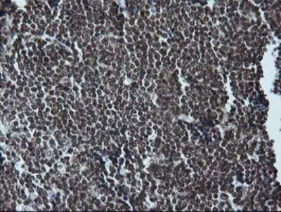 Immunohistochemistry: ERK1 Antibody (OTI4D7) [NBP2-45814]