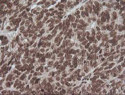 Immunohistochemistry: ERK1 Antibody (OTI4D7) [NBP2-45814]