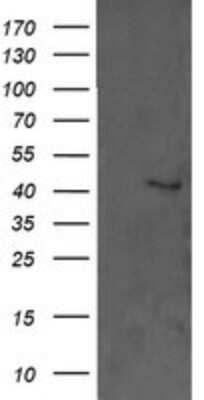 Western Blot: ERK1 Antibody (OTI4D7) [NBP2-45814]