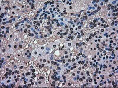 Immunohistochemistry-Paraffin: ERK2 Antibody (OTI6E5) [NBP1-47842]