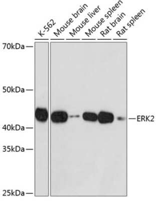 Western Blot: ERK2 Antibody (2K9N9) [NBP3-15826]