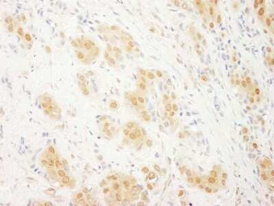 Immunohistochemistry-Paraffin: ERK2 Antibody [NBP1-19102]