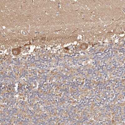Immunohistochemistry-Paraffin: ERK2 Antibody [NBP1-87943]